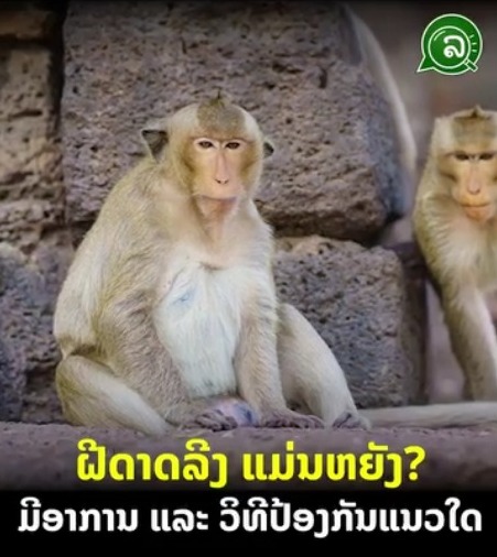 ຝີດາດລີງ ແມ່ນຫຍັງ? ມີອາການ ແລະ ວິທີປ້ອງກັນແນວໃດ